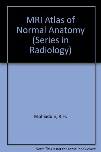 Imagen de archivo de MRI Atlas of Normal Anatomy a la venta por P.C. Schmidt, Bookseller