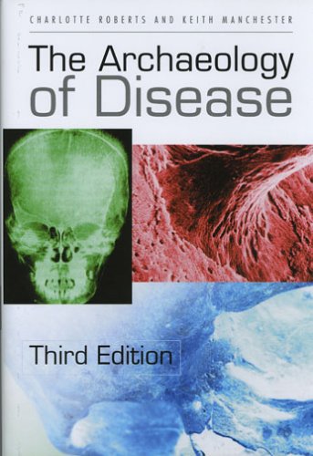 Stock image for The Archaeology of Disease, third edition for sale by N. Fagin Books