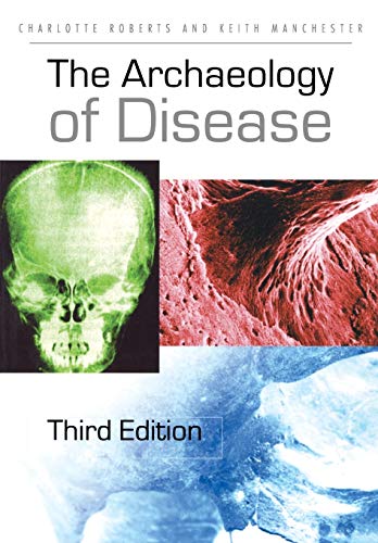 Beispielbild fr The Archaeology of Disease zum Verkauf von Better World Books