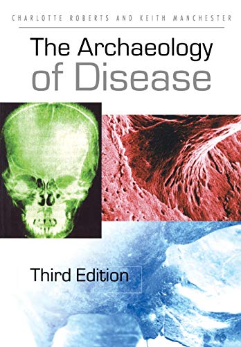 The Archaeology of Disease - Roberts, Charlotte; Manchester, Keith