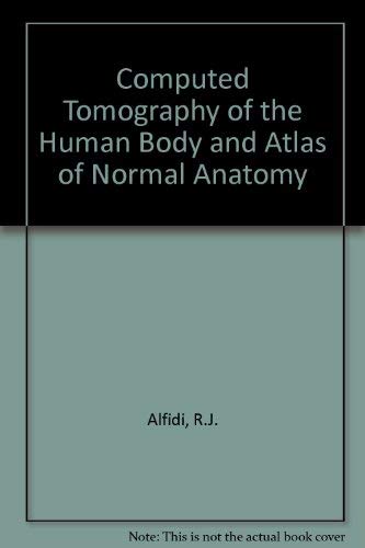 Beispielbild fr Computed Tomography of the Human Body : An Atlas of Normal Anatomy zum Verkauf von Better World Books