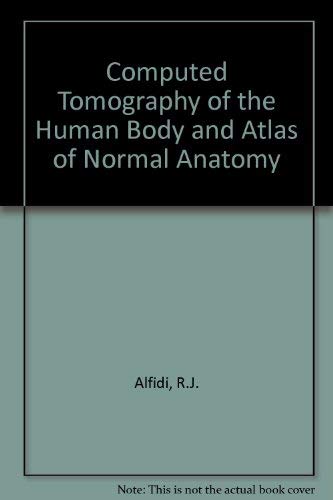 Stock image for Computerized Tomography of the Human Body: An Atlas of Normal Anatomy for sale by P.C. Schmidt, Bookseller