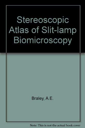 Stereoscopic atlas of slit-lamp biomicroscopy. Volumes 1 & 2 (9780801607301) by Alison E. Braley; Robert C. Watzke; Lee Allen; Ogden Frazier