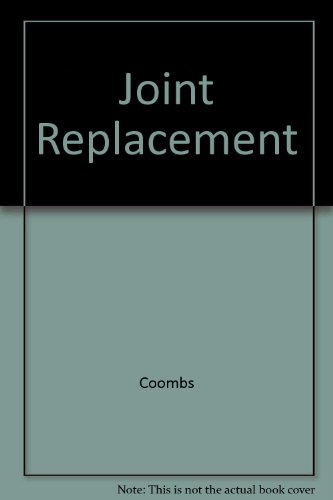 9780801611711: Joint Replacement: State of the Art