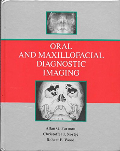 Oral and Maxillofacial Diagnostic Imaging (9780801615498) by Farman, Allan G.; Nortje, Christoffel J.; Wood, Robert E.