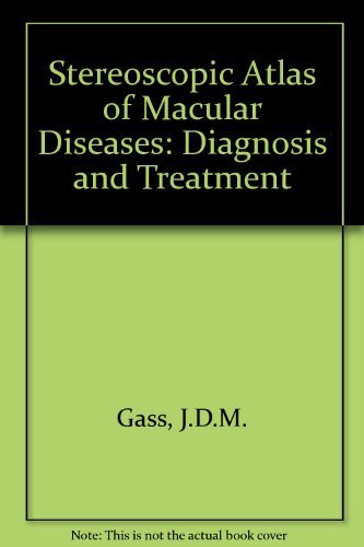 Stock image for Stereoscopic Atlas of Macular Diseases: Diagnosis and Treatment for sale by BOOK'EM, LLC