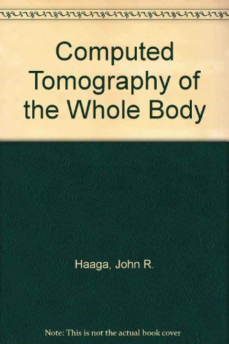 Computed Tomography of the Whole Body (Volume One)