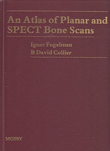 Stock image for An Atlas of Planar and Spect Bone Scans for sale by GoldenWavesOfBooks