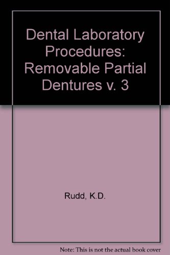 9780801635168: Removable Partial Dentures (v. 3) (Dental Laboratory Procedures)