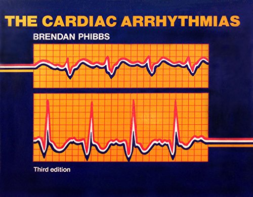 9780801639111: Cardiac Arrhythmias
