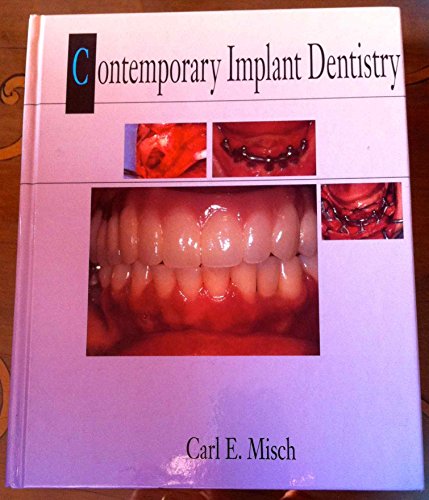 Beispielbild fr Contemporary Implant Dentistry zum Verkauf von SecondSale