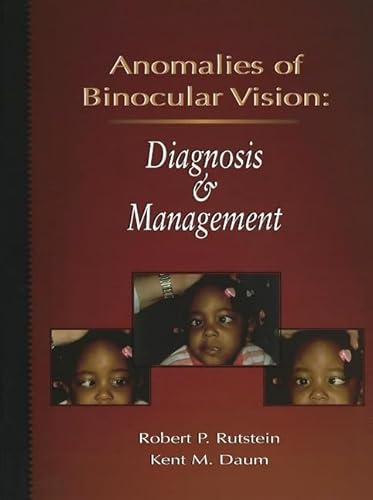 Imagen de archivo de Anomalies of Binocular Vision: Diagnosis & Management a la venta por Revaluation Books