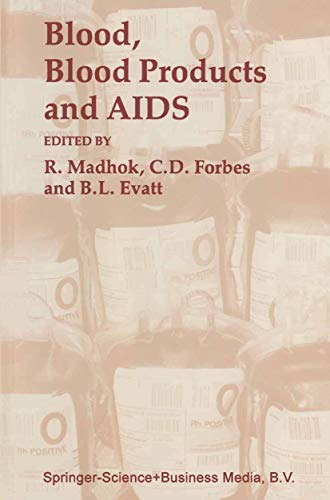 9780801836084: Blood, Blood Products ― and AIDS ― (Johns Hopkins Series in Contemporary Medicine and Public Health)