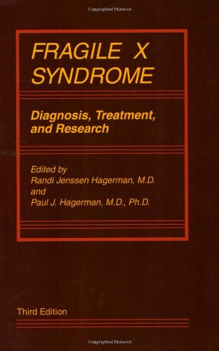 9780801868443: Fragile X Syndrome: Diagnosis, Treatment, and Research (Johns Hopkins Series in Contemporary Medicine and Public Hea)