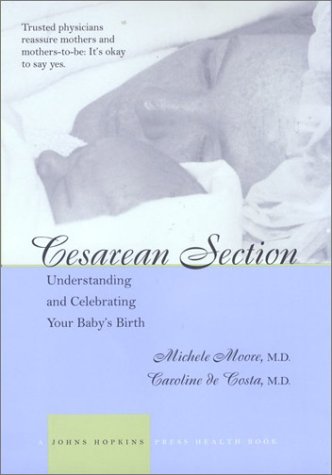 9780801873362: Cesarean Section: Understanding and Celebrating Your Baby's Birth (A Johns Hopkins Press Health Book)