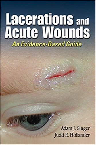 Imagen de archivo de Lacerations and Acute Wounds: An Evidence-Based Guide a la venta por Books of the Smoky Mountains