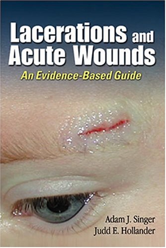 Stock image for Lacerations and Acute Wounds: An Evidence-Based Guide for sale by ThriftBooks-Dallas