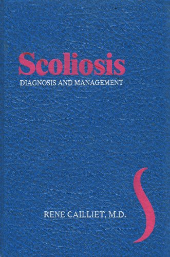 9780803616400: Scoliosis: Diagnosis and Management