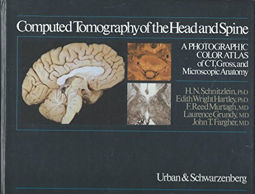 Beispielbild fr Computed tomography of the head and spine: A photographic color atlas of CT, gross, and microscopic anatomy zum Verkauf von HPB-Red