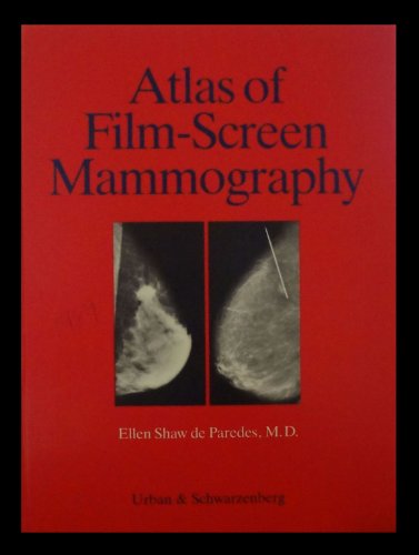 Imagen de archivo de Atlas of Film-Screen Mammography a la venta por Bingo Used Books