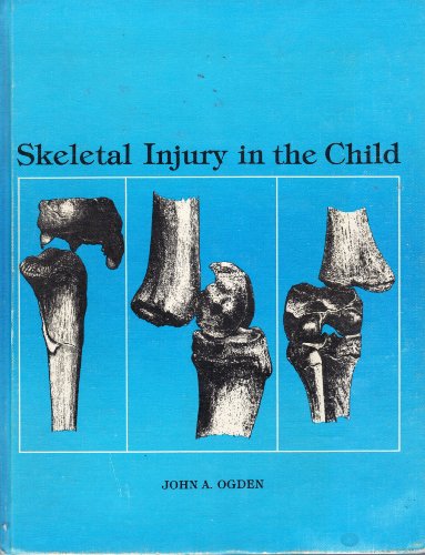 9780812108095: Skeletal injury in the child