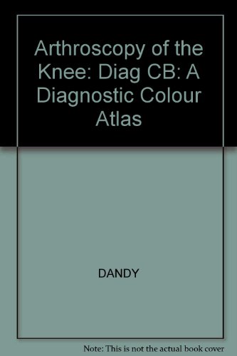 Imagen de archivo de Arthroscopy of the Knee : A Diagnostic Color Atlas a la venta por ThriftBooks-Dallas