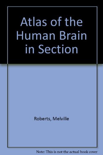 Atlas of the Human Brain in Section (9780812110302) by Roberts, Melville P.; Hanaway, Joseph; Morest, D. Kent