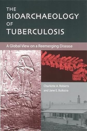 Beispielbild fr The Bioarchaeology of Tuberculosis : A Global View on a Reemerging Disease zum Verkauf von Better World Books