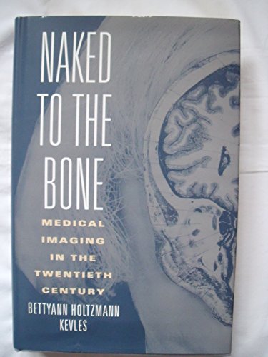 Imagen de archivo de Naked to the Bone: Medical Imaging in the Twentieth Century (Sloan Technology Series) a la venta por More Than Words