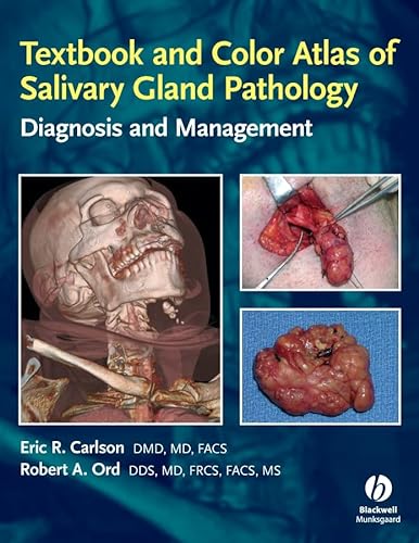 Beispielbild fr Textbook and Color Atlas of Salivary Gland Pathology: Diagnosis and Management zum Verkauf von Books From California