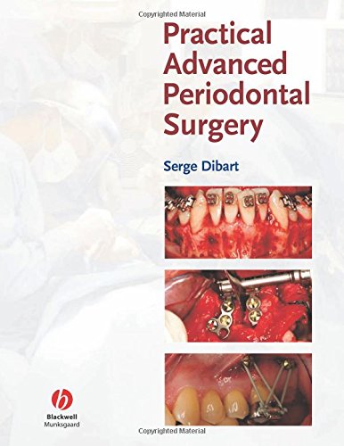 9780813809571: Practical Advanced Periodontal Surgery