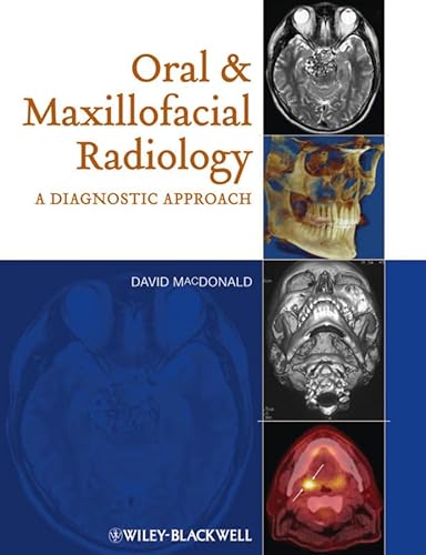 Oral and Maxillofacial Radiology: A Diagnostic Approach (9780813814148) by MacDonald, David