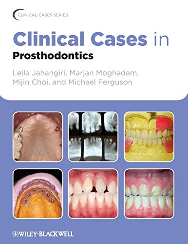 Stock image for Clinical Cases in Prosthodontics for sale by Blackwell's