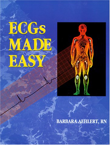 Stock image for ECG's Made Easy for sale by Better World Books