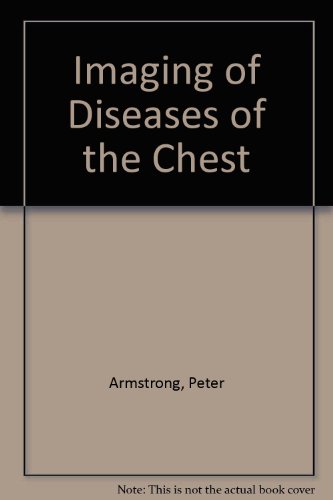 9780815103509: Imaging of diseases of the chest