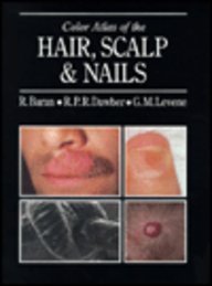 Stock image for Color Atlas of the Hair, Scalp and Nails for sale by ThriftBooks-Dallas