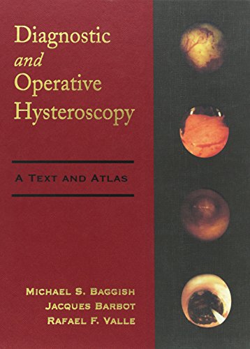 9780815104575: Diagnostic and Operative Hysteroscopy: A Text and Atlas