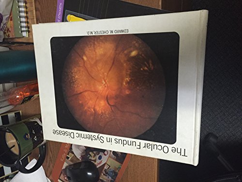 Stock image for The ocular fundus in systemic disease;: A clinical pathological correlation for sale by SecondSale