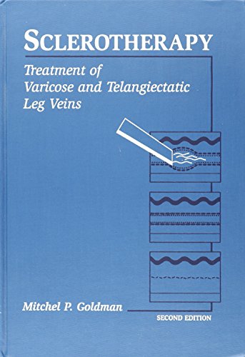 Imagen de archivo de Sclerotherapy: Treatment of Varicose and Telangiectatic Leg Veins a la venta por HPB-Red