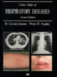 Imagen de archivo de A Colour Atlas of Respiratory Diseases a la venta por Vashon Island Books