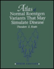 Stock image for Atlas of Normal Roentgen Variants That May Stimulate Disease for sale by HPB-Red