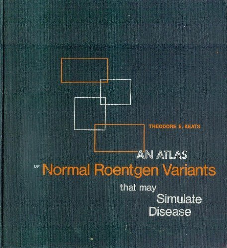 Stock image for An atlas of normal roentgen variants that may simulate disease for sale by Idaho Youth Ranch Books