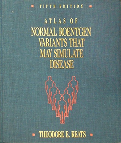 9780815150480: Atlas of Normal Roentgen Variants That May Simulate Disease