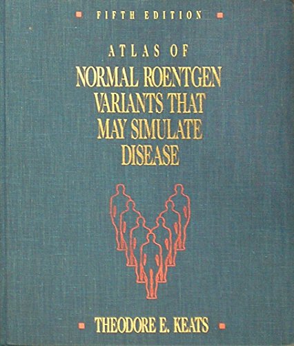 Stock image for Atlas of Normal Roentgen Variants That May Simulate Disease for sale by HPB-Red