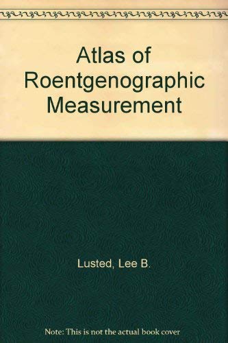 Stock image for Atlas of Roentgenographic Measurement for sale by Cronus Books