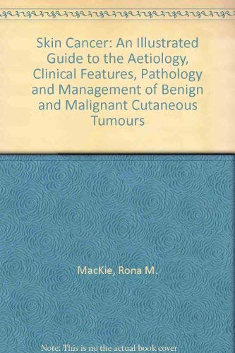 Beispielbild fr Skin Cancer: An Illustrated Guide to the Aetiology, Clinical Features, Pathology and Management of Benign and Malignant Cutaneous Tumours zum Verkauf von Wonder Book