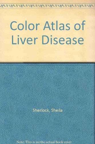 Color Atlas of Liver Disease (9780815166344) by Sherlock, Sheila; Summerfield, John A.