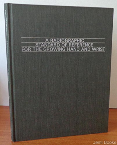 Stock image for A Radiographic standard of reference for the growing hand and wrist for sale by West Coast Bookseller