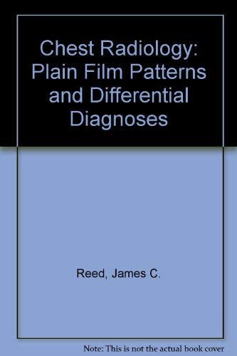 Imagen de archivo de Chest radiology: Plain film patterns and differential diagnoses a la venta por HPB-Emerald