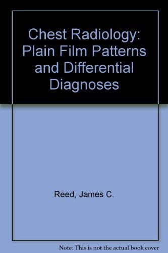 9780815171249: Chest Radiology: Plain Film Patterns and Differential Diagnoses